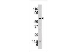 Image no. 1 for anti-V-Akt Murine Thymoma Viral Oncogene Homolog 1 (AKT1) (pTyr326) antibody (ABIN358077) (AKT1 antibody  (pTyr326))