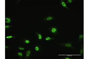 Immunofluorescence of monoclonal antibody to MZF1 on HeLa cell. (MZF1 antibody  (AA 419-518))