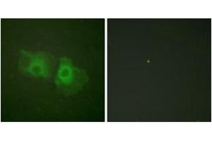 Immunofluorescence analysis of HeLa cells, using Keratin 18 (Ab-33) Antibody.