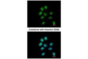 ICC/IF Image Immunofluorescence analysis of paraformaldehyde-fixed A431, using ZNF143, antibody at 1:500 dilution.