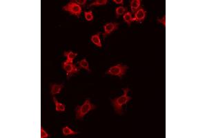ABIN6268813 staining HuvEC by IF/ICC. (CD70 antibody  (Internal Region))