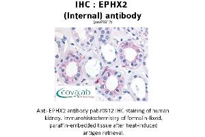 Image no. 1 for anti-Epoxide Hydrolase 2, Cytoplasmic (EPHX2) (Internal Region) antibody (ABIN1734089)