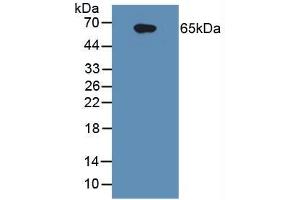 Figure. (IL1R1 antibody  (AA 21-109))