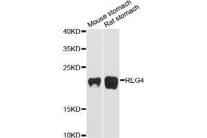 Western blot analysis of extracts of various cell lines, using REG4 antibody.