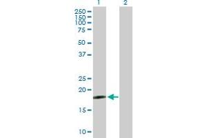 Western Blot analysis of DNAJC5G expression in transfected 293T cell line by DNAJC5G MaxPab polyclonal antibody. (DNAJC5G antibody  (AA 1-189))