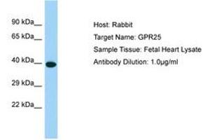 Image no. 1 for anti-G Protein-Coupled Receptor 25 (GPR25) (C-Term) antibody (ABIN6750184) (GPR25 antibody  (C-Term))