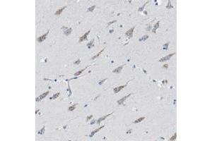 Immunohistochemical staining of human hippocampus with WBSCR17 polyclonal antibody  shows moderate cytoplasmic positivity in neuronal cells.