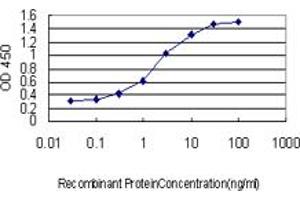 Detection limit for recombinant GST tagged STAR is approximately 0. (STAR antibody  (AA 81-180))