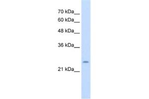 Western Blotting (WB) image for anti-Cysteine-Rich Hydrophobic Domain 1 (CHIC1) antibody (ABIN2463993) (CHIC1 antibody)