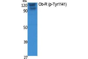Western Blotting (WB) image for anti-Leptin Receptor (LEPR) (pTyr1141) antibody (ABIN3173572) (Leptin Receptor antibody  (pTyr1141))