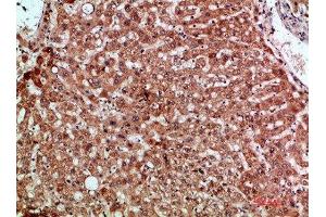 Immunohistochemical analysis of paraffin-embedded human-liver, antibody was diluted at 1:200 (CCL2 antibody  (AA 31-80))