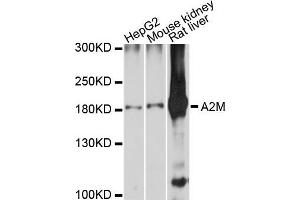 Western blot analysis of extracts of various cell lines, using A2M antibody. (alpha 2 Macroglobulin antibody)