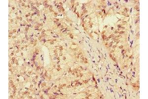 Immunohistochemistry of paraffin-embedded human adrenal gland tissue using ABIN7150120 at dilution of 1:100 (ZRANB3 antibody  (AA 370-624))