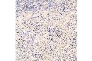 Immunohistochemistry analysis of paraffin-embedded rat spleen using,Tal1 (ABIN7075819) at dilution of 1: 1500 (TAL1 antibody)