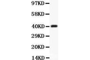 CD3 epsilon antibody  (AA 23-207)