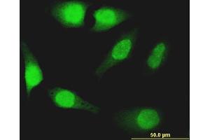 Immunofluorescence of monoclonal antibody to FOXO1 on HeLa cell. (FOXO1 antibody  (AA 452-555))