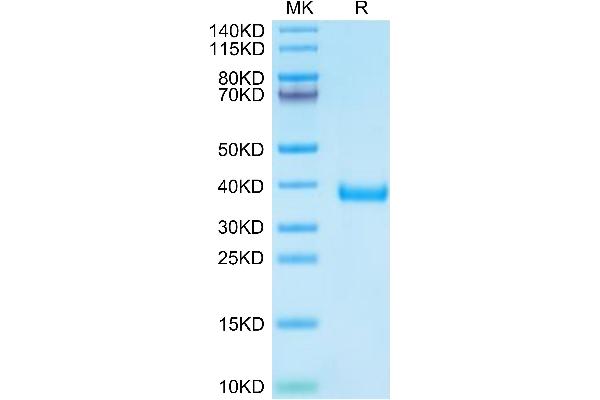 MFAP4 Protein (AA 60-293) (His tag)
