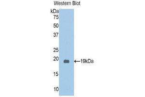 Western Blotting (WB) image for anti-Protein Kinase N2 (PKN2) (AA 323-464) antibody (ABIN1860246)