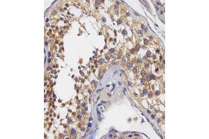 staining BPC3 in human testis tissue sections by Immunohistochemistry (IHC-P - raformaldehyde-fixed, raffin-embedded sections). (PABPC3 antibody  (AA 84-117))