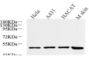 Western Blot analysis of various samples using CK-17 Polyclonal Antibody at dilution of 1:600. (KRT17 antibody)