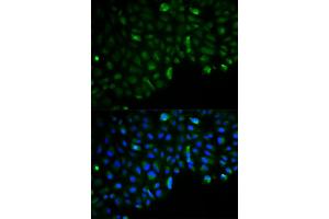 Immunofluorescence analysis of U2OS cells using HK2 antibody. (Hexokinase 2 antibody)