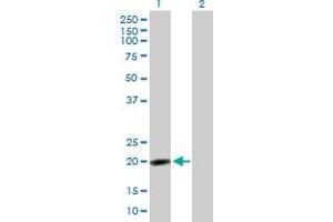 Western Blot analysis of NPM3 expression in transfected 293T cell line by NPM3 MaxPab polyclonal antibody.