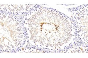 Detection of RLN in Rat Testis Tissue using Polyclonal Antibody to Relaxin (RLN) (Relaxin antibody  (AA 23-186))