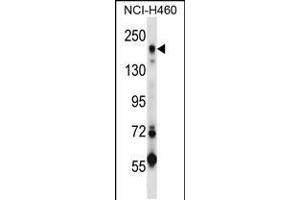 Western blot analysis in NCI-H460 cell line lysates (35ug/lane). (MRC2 antibody  (AA 798-827))