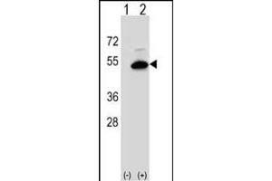 Western blot analysis of SGMS2 (arrow) using rabbit polyclonal SGMS2 Antibody (C-term) (ABIN653696 and ABIN2843015).