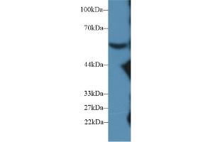Detection of C8b in Mouse Serum using Polyclonal Antibody to Complement Component 8b (C8b) (C8B antibody  (AA 161-503))