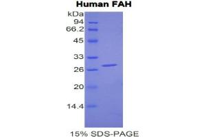 SDS-PAGE analysis of Human FAH Protein.
