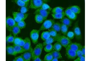 IF analysis of GFPT1 using anti-GFPT1 antibody (ABIN7602887).