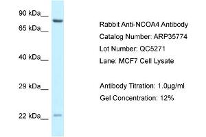 WB Suggested Anti-NCOA4 Antibody   Titration: 1. (NCOA4 antibody  (C-Term))