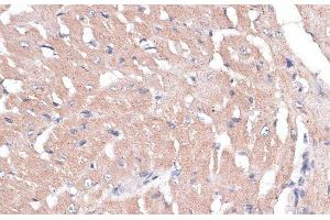 Immunohistochemistry of paraffin-embedded Mouse heart using COL11A1 Polyclonal Antibody at dilution of 1:100 (40x lens). (COL11A1 antibody)