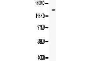 Western Blotting (WB) image for anti-Fms-Related tyrosine Kinase 1 (VEGFR1) (FLT1) (AA 278-298), (N-Term) antibody (ABIN3042978) (FLT1 antibody  (N-Term))