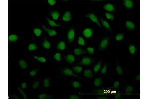 Immunofluorescence of monoclonal antibody to RAD51C on HeLa cell. (RAD51C antibody  (AA 1-134))