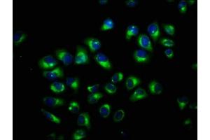 Immunofluorescence staining of Hela cells with ABIN7173590 at 1:100, counter-stained with DAPI. (FAM115C antibody  (AA 472-590))
