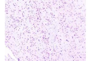 IHC analysis of RPS3 using anti-RPS3 antibody (ABIN6719371). (RPS3 antibody)