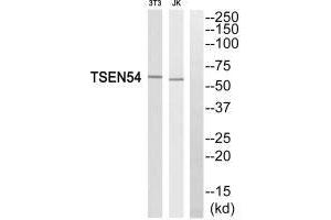Western blot analysis of extracts from 3T3 cells and Jurkat cells, using TSEN54 antibody. (TSEN54 antibody)