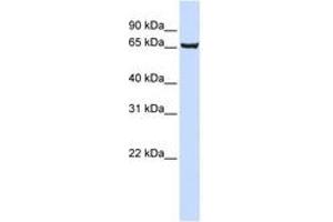 Image no. 1 for anti-SRY (Sex Determining Region Y)-Box 13 (SOX13) (AA 531-580) antibody (ABIN6741428)