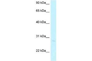 WB Suggested Anti-ABHD12B Antibody Titration: 1. (ABHD12B antibody  (Middle Region))