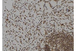 ABIN6272612 at 1/100 staining Human gastric tissue by IHC-P.