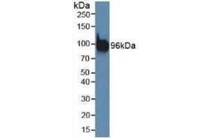 Detection of PDCD6IP in Mouse Brain Tissue using Polyclonal Antibody to Programmed Cell Death Protein 6 Interacting Protein (PDCD6IP) (ALIX antibody  (AA 1-239))