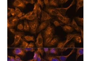 Immunofluorescence analysis of U-2 OS cells using SEPT5 Polyclonal Antibody at dilution of 1:100. (Septin 5 antibody)