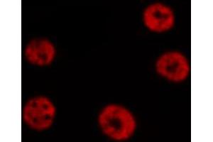 ABIN6267511 staining HeLa by IF/ICC. (STAT6 antibody  (pThr645))