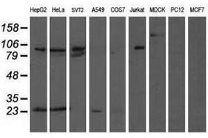 Image no. 2 for anti-Anaphase Promoting Complex Subunit 2 (ANAPC2) antibody (ABIN1496638) (ANAPC2 antibody)