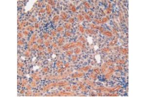 IHC-P analysis of Rat Kidney Tissue, with DAB staining. (MMP12 antibody  (AA 20-99))