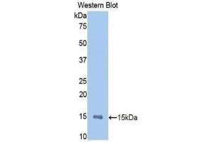 Detection of Recombinant MMP12, Rat using Polyclonal Antibody to Matrix Metalloproteinase 12 (MMP12) (MMP12 antibody  (AA 372-463))