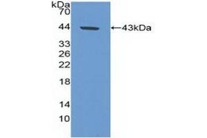 Detection of Recombinant CA9, Human using Polyclonal Antibody to Carbonic Anhydrase IX (CA9) (CA9 antibody  (AA 59-414))