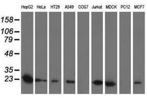 Image no. 2 for anti-Superoxide Dismutase 2, Mitochondrial (SOD2) antibody (ABIN1499530)